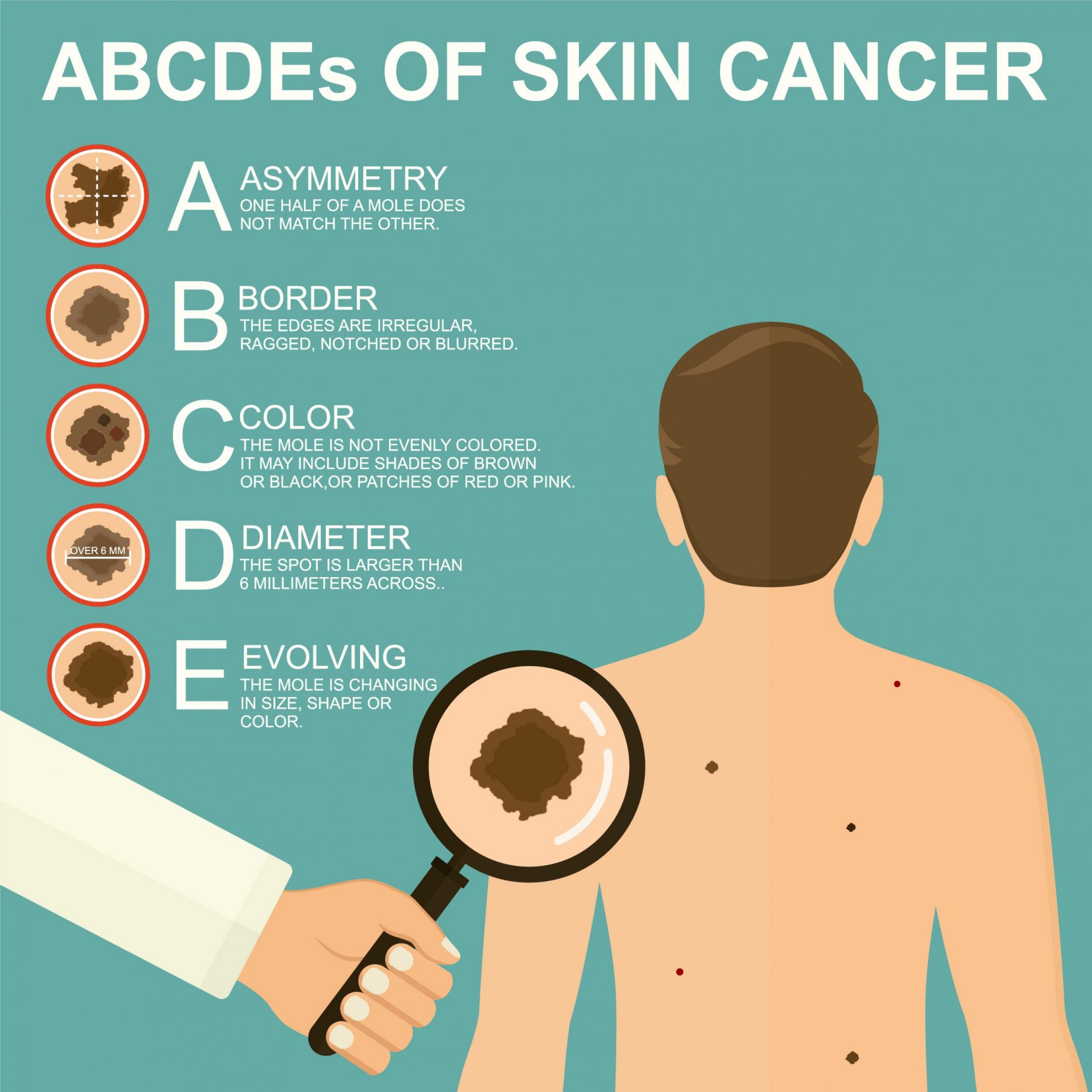 about-skin-cancers-showground-skin-cancer